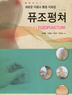 퓨조펑쳐