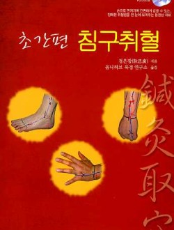 초간편 침구취혈 (vod 2장 포함)