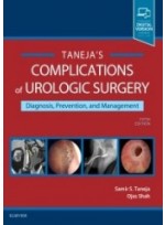 Complications of Urologic Surgery, 5/e 