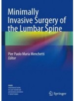 Minimally Invasive Surgery of the Lumbar Spine 