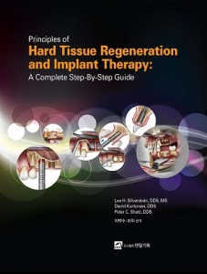 Principles of Hard Tissue Regeneration and Implant Therapy: A complete Step-By-Step Guide