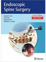 Endoscopic Spine Surgery 2nd Edition
